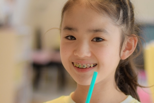 永久歯列期にワイヤー矯正を受けている子ども